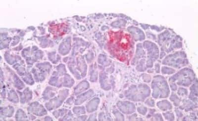 Immunohistochemistry-Paraffin: Amylin Antibody [NBP3-14540]